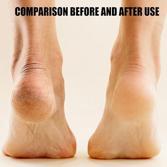 Electronic Pedicure Tool